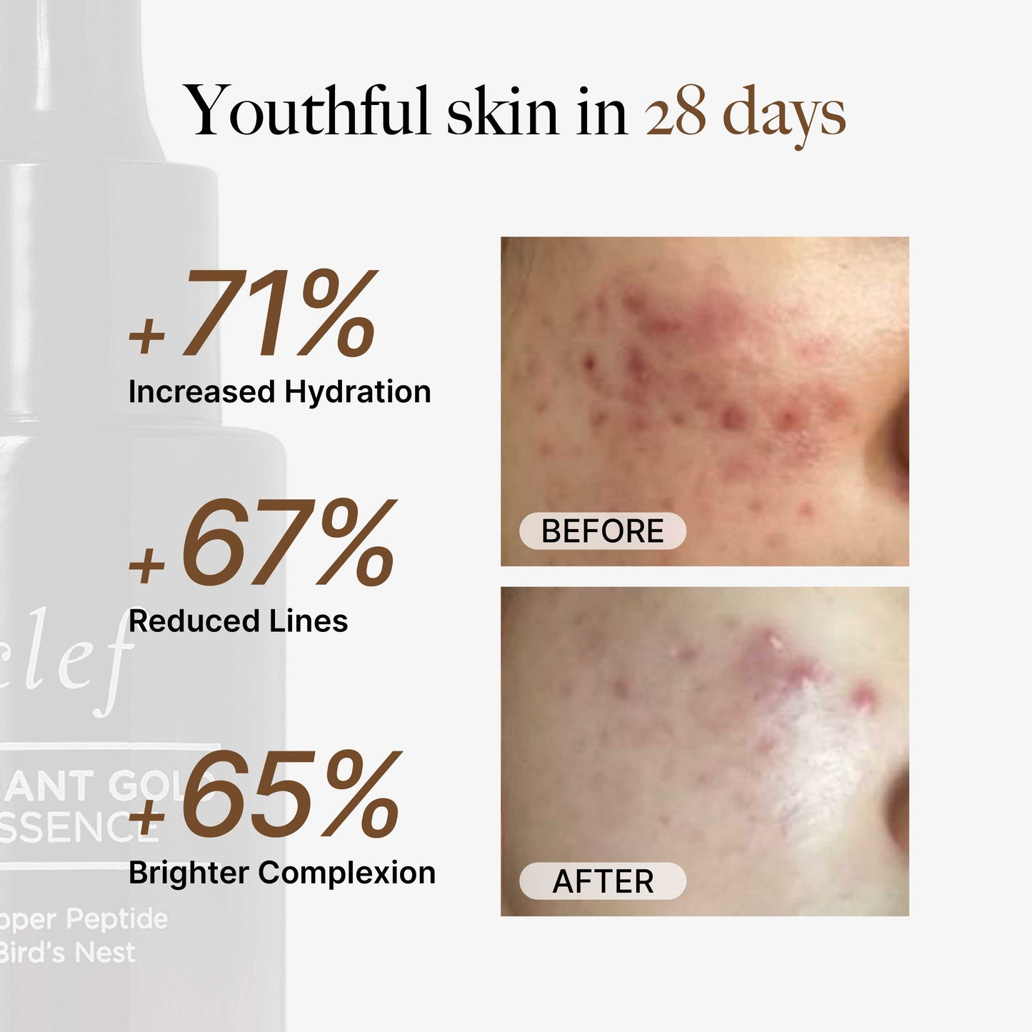 CLEF Radiant Gold Essence 30ml | Absorbs in 5 Secs | Antioxidant, Repairing | Smoothens & Firms Skin